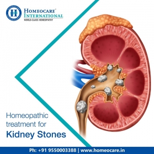 Homeopathy Treatment for Kidney Stones - Homeocare